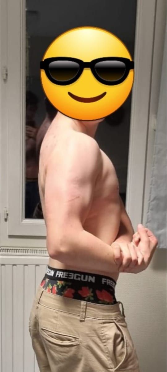 Profil von Bily
